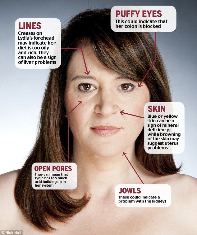 Stress Spots On Face